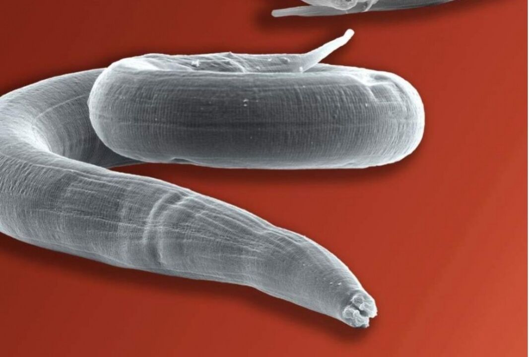 giza gorputzetik oxiuroa
